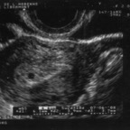 echo_2007-10-08_1
