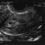 echo_2007-10-08_2