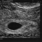 echo_2007-10-12_1
