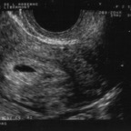 echo_2007-10-12_2