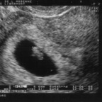 echo_2007-10-22_1