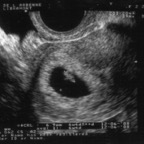 echo_2007-10-22_2