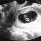 echo_2007-10-30_1