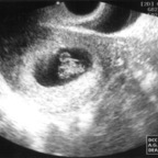 echo_2007-10-30_2
