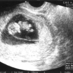 echo_2007-11-12_1
