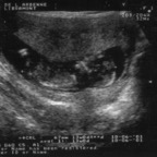 echo_2007-12-03_1