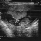 echo_2007-12-03_2