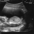 echo_2007-12-19_1