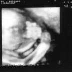 echo_2008-02-07_1