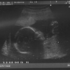 echo_2008-02-13_1