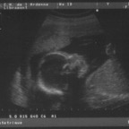 echo_2008-02-13_2
