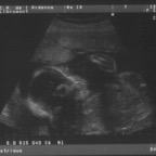 echo_2008-02-13_3