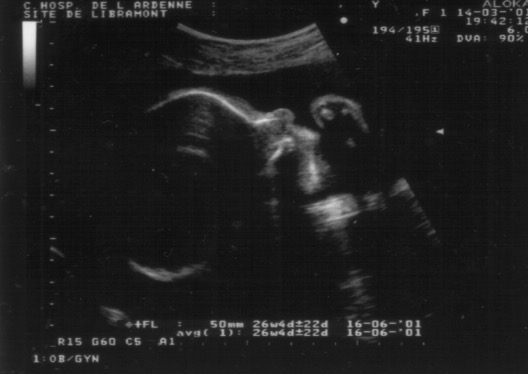 14/3/2008 - 1