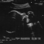 echo_2008-03-14_1