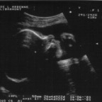 echo_2008-03-14_2jpg