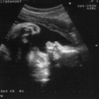 echo_2008-04-12_1