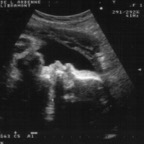 echo_2008-04-12_2